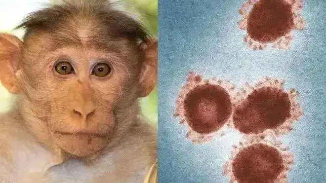 美国旧金山因猴痘疫情进入卫生紧急状态