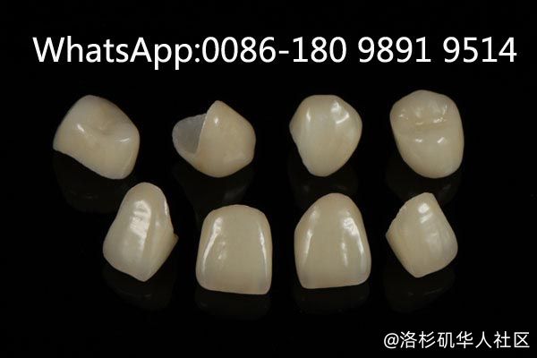 The Advantages Of China outsourcing Dental Lab