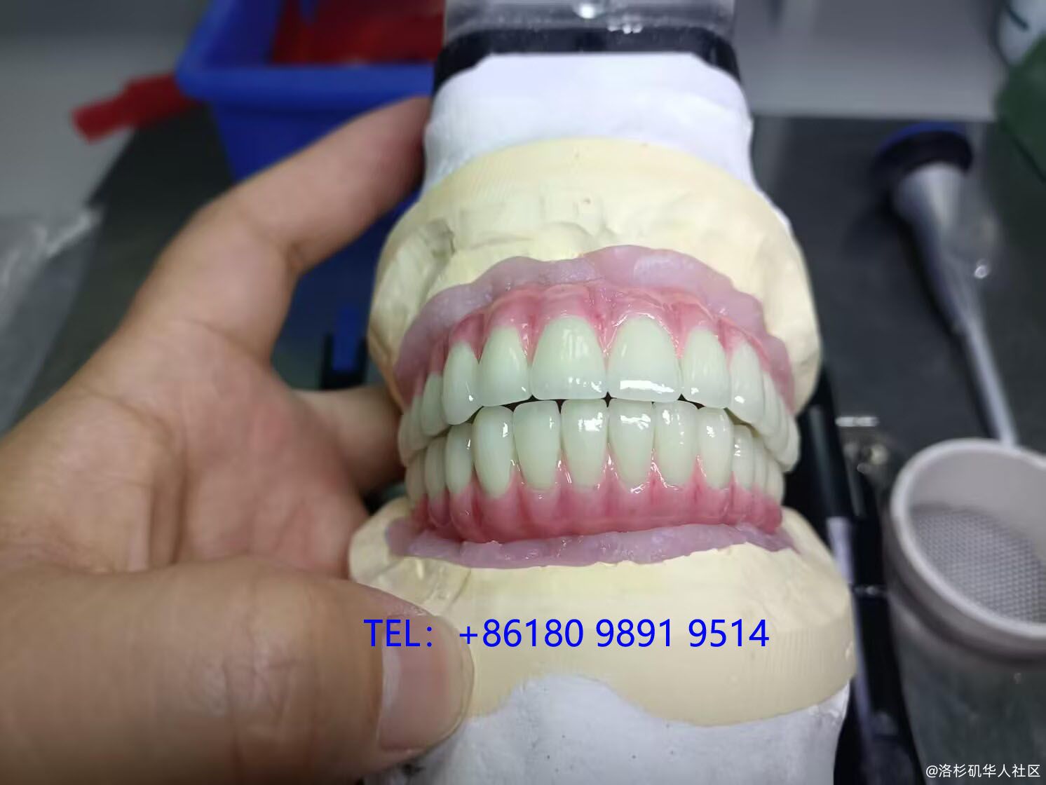 Dental lab in ShenChina (深圳义齿加工厂）