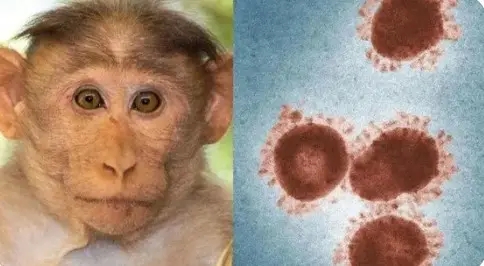 洛杉矶报告首例猴痘疑似病例
